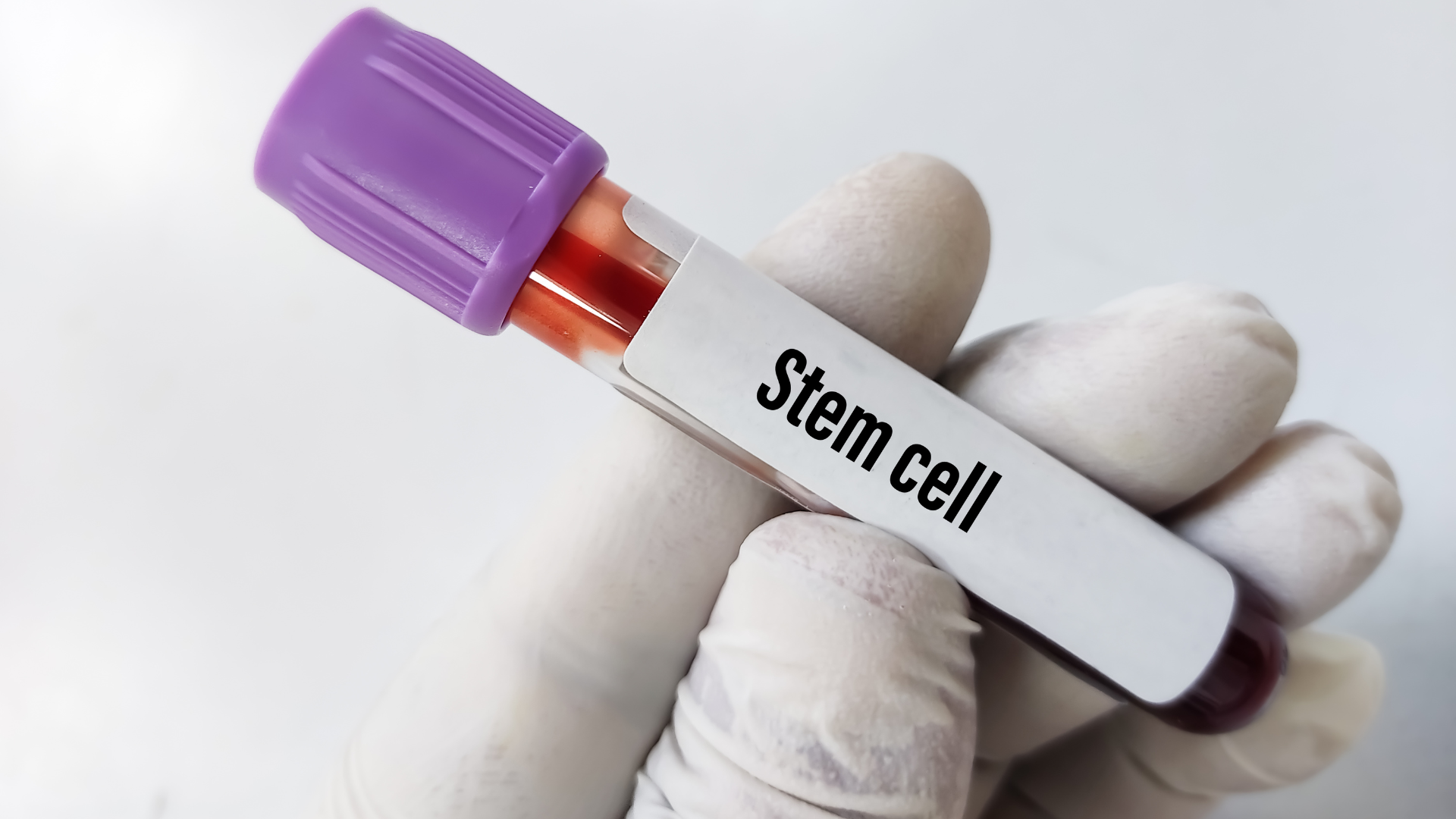 Stem Cell Clinic Mexico