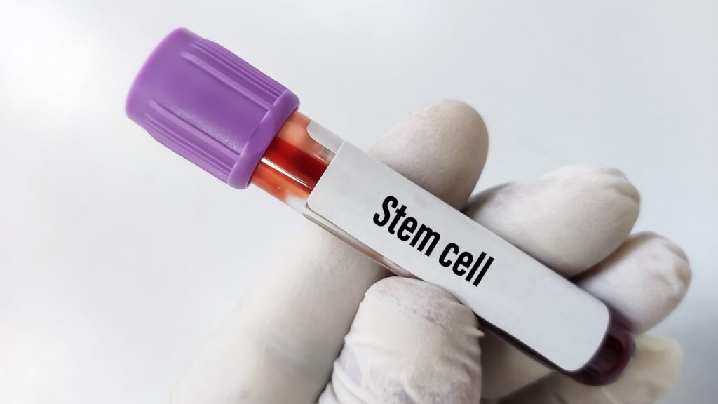 Stem Cell Clinic Mexico