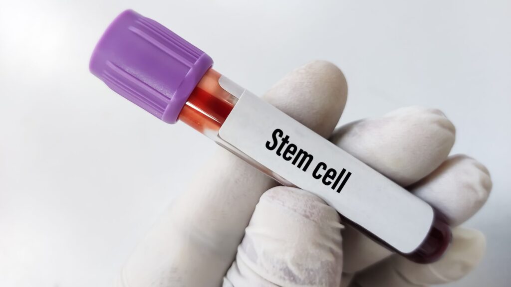 Stem Cell Clinic Mexico