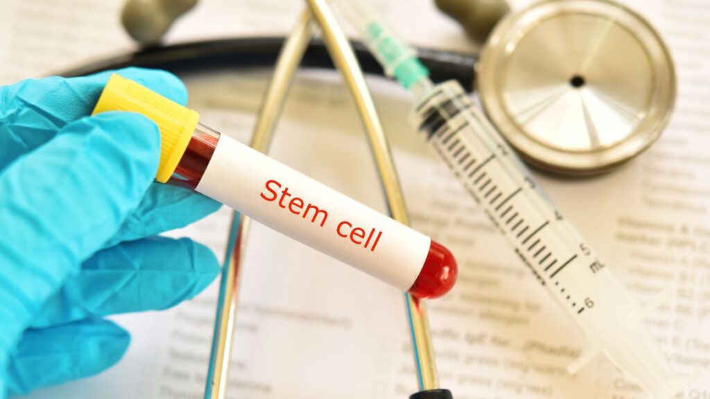 Stem Cell Clinic Mexico