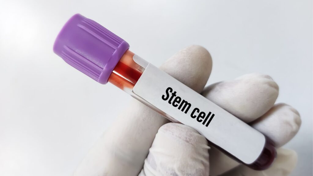 Stem Cell Clinic Mexico