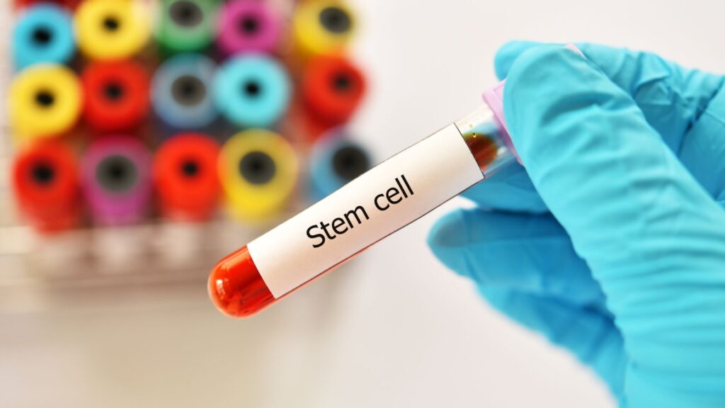 Stem Cell Clinic Mexico