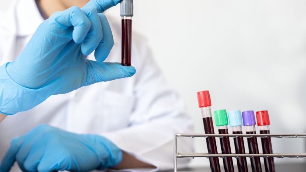 How Is Stem Cell Therapy for Back Pain Performed