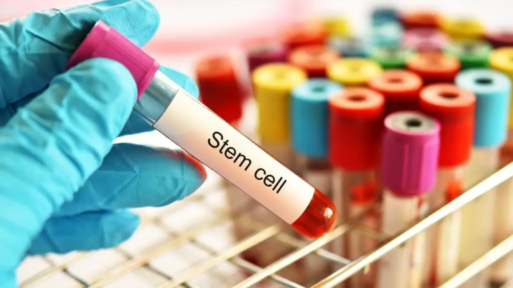 What Results Can You Expect from Stem Cell Treatment