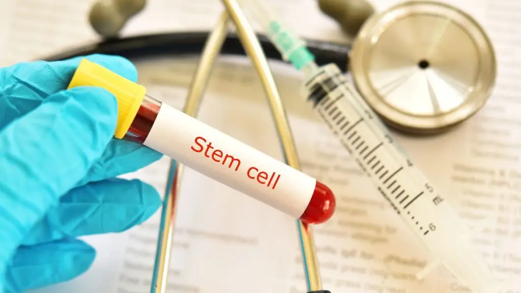 What to Expect Timeline and Outcomes of Stem Cells for Bulging Disc