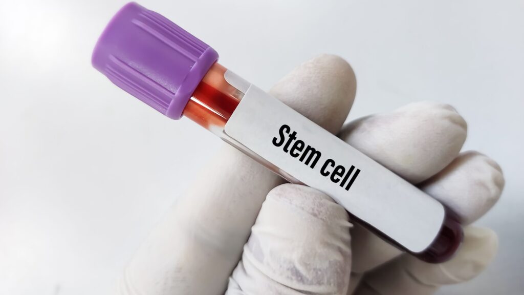 Why Mesenchymal Stem Cells from Wharton’s Jelly