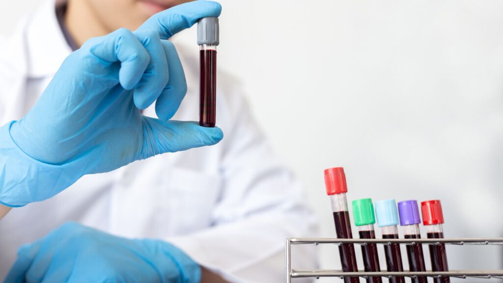 Kim Kardashian’s Stem Cell Journey