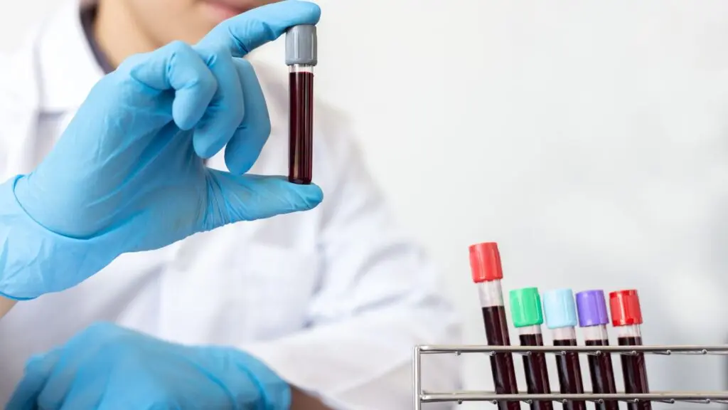 Kim Kardashian’s Stem Cell Journey