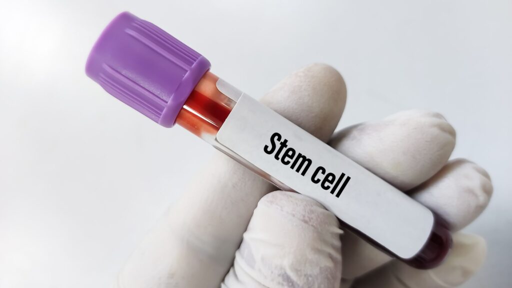 Why Mesenchymal Stem Cells from Wharton’s Jelly