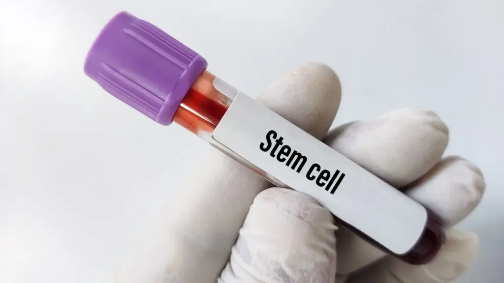 Why Mesenchymal Stem Cells from Wharton’s Jelly Why Mesenchymal Stem Cells from Wharton’s Jelly