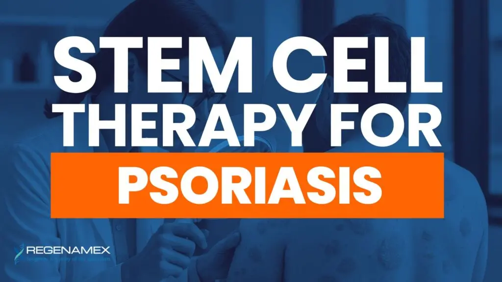 Stem Cell Therapy for Psoriasis A Complete Guide to Regenerative Treatment at Regenamex