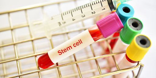 stem cell therapy