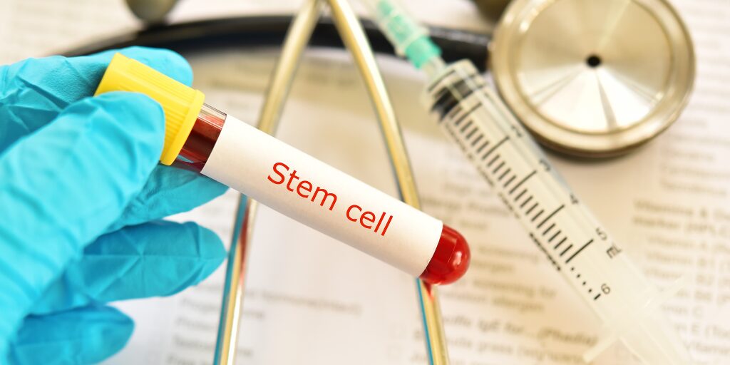 Tijuana Mexico stem cell therapy