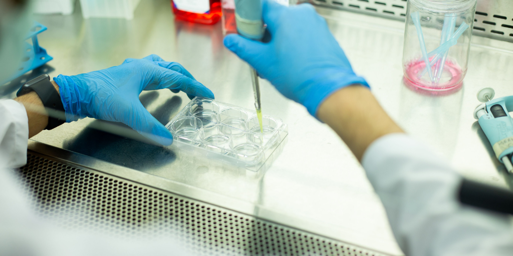 Stem Cell Therapy for Autism