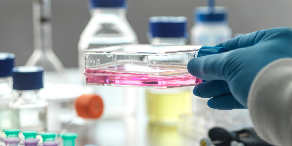 stem cell therapy in Mexico